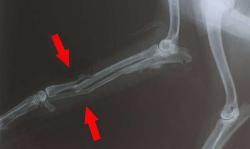X-rays
